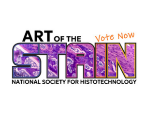 Art of the Stain Vote Today